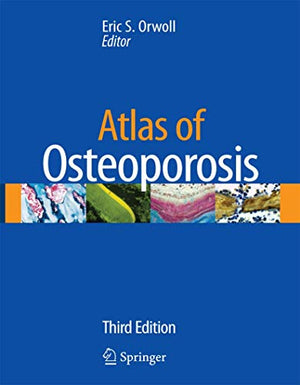 Atlas of Osteoporosis