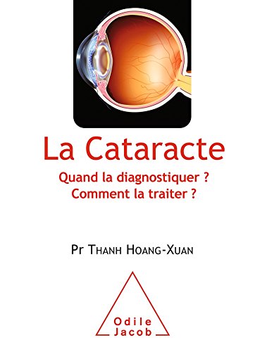 La Cataracte: Quand la diagnostiquer ? Comment la traiter ?