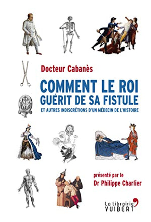 Comment le roi guérit de sa fistule