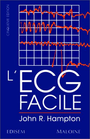 L'ECG facile