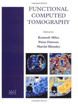 Functional Computed Tomography