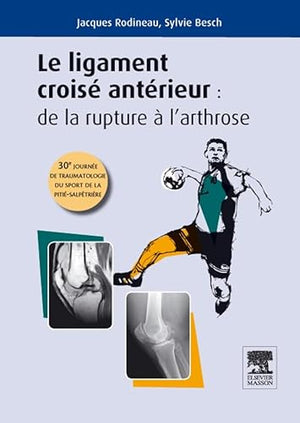 LIGAMENT CROISE ANTERIEUR