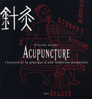 Acupuncture : L'histoire et la pratique d'une médecine ancestrale