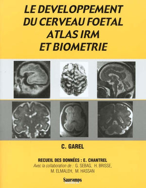 Developpement du cerveau foetal