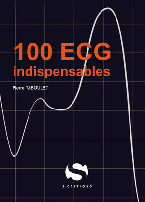 100 ecg indispensables