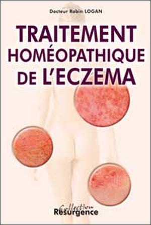 Traitement homéopathique de l'eczéma