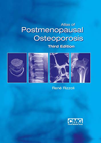 Atlas of Postmenopausal Osteoporosis: Third Edition
