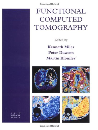 Functional Computed Tomography