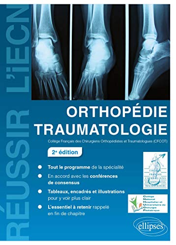 Orthopédie Traumatologie - 2e édition